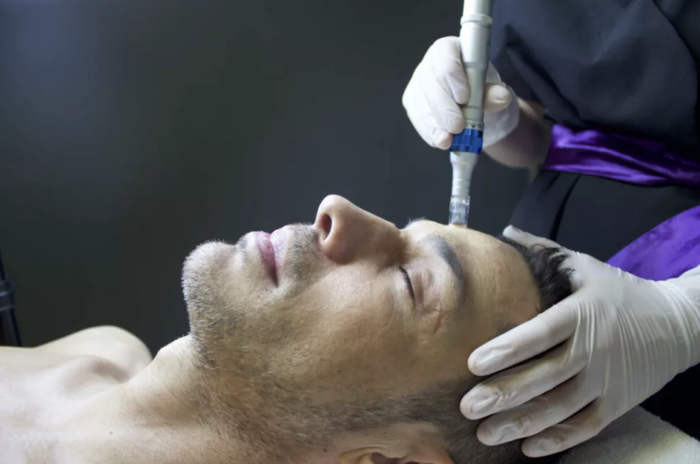 additional additional