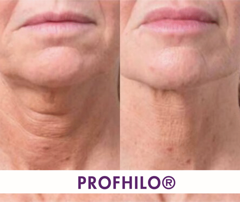 SA mixed H 20 768x648