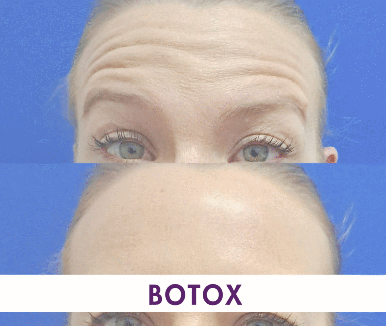 SA mixed H 22 768x648