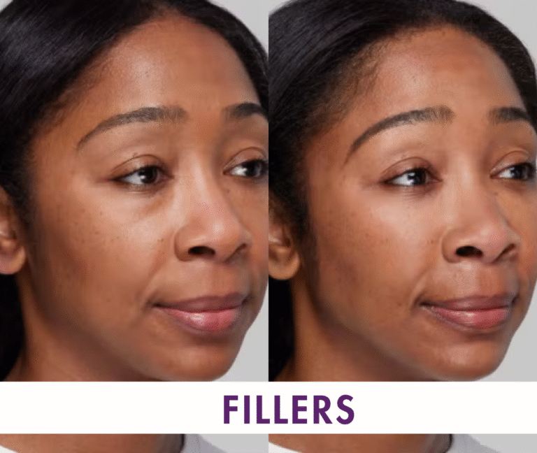 SA mixed H 24 768x648