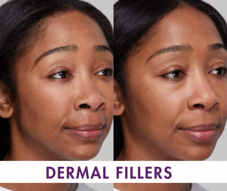 SA mixed H 27 1 768x648