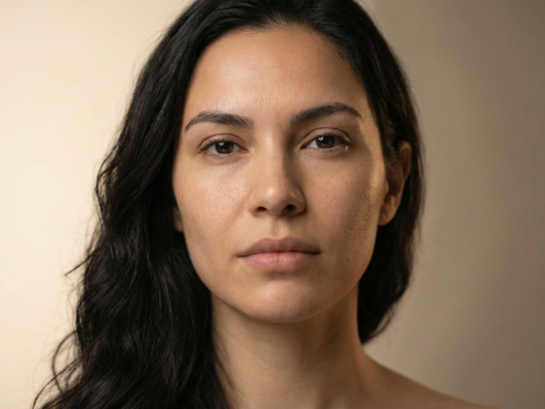 Acne removal from face 768x576